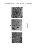 MEMBRANE RESIDENT PEPTIDE IN ANTI-CANCER PEPTIDES CAUSES TUMOR CELL     NECROSIS RATHER THAN APOPTOSIS OF CANCER CELLS diagram and image