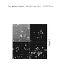 MEMBRANE RESIDENT PEPTIDE IN ANTI-CANCER PEPTIDES CAUSES TUMOR CELL     NECROSIS RATHER THAN APOPTOSIS OF CANCER CELLS diagram and image