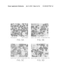 Methods of Treating Pediatric Acute Lymphoblastic Leukemia with an     Anti-CD22 Immunotoxin diagram and image