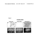 AMYLOID IMAGING AS A SURROGATE MARKER FOR EFFICACY OF ANTI-AMYLOID     THERAPIES diagram and image