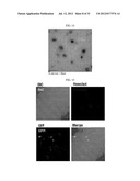 MICROVESICLES DERIVED FROM NUCLEATED, MAMMALIAN CELLS AND USE THEREOF diagram and image