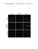 MICROVESICLES DERIVED FROM NUCLEATED, MAMMALIAN CELLS AND USE THEREOF diagram and image