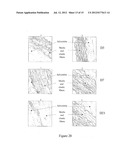 USE OF GINGIVAL FIBROBLASTS FOR VASCULAR CELL THERAPY diagram and image