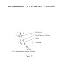 USE OF GINGIVAL FIBROBLASTS FOR VASCULAR CELL THERAPY diagram and image