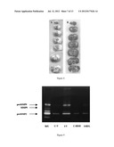 HDL COMPRISING A THERAPEUTIC AGENT AND USE IN THERAPY diagram and image