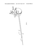 SURGICAL ACCESS SYSTEM AND RELATED METHODS diagram and image