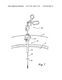 ACCESS SEALING APPARATUS AND METHOD diagram and image