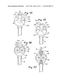 ACCESS SEALING APPARATUS AND METHOD diagram and image