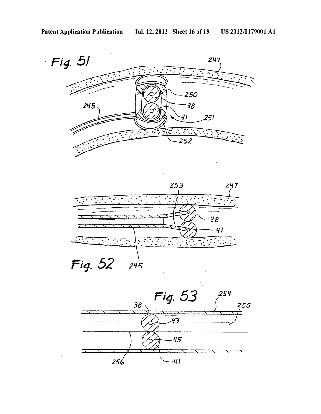 ACCESS SEALING APPARATUS AND METHOD - diagram, schematic, and image 17
