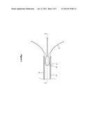 RELEASABLE MEDICAL BASKET AND RELATED METHODS OF USE diagram and image