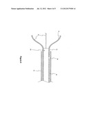 RELEASABLE MEDICAL BASKET AND RELATED METHODS OF USE diagram and image