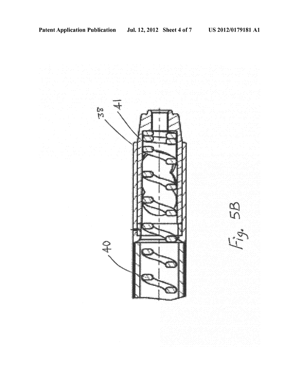 CATHETER COMPRISING A PROTECTION SYSTEM FOR ASPIRATING, FRAGMENTING AND     EXTRACTING REMOVABLE MATERIAL FROM HOLLOW BODIES OR VESSELS OF A HUMAN OR     ANIMAL BODY - diagram, schematic, and image 05