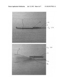 CATHETER COMPRISING A PROTECTION SYSTEM FOR ASPIRATING, FRAGMENTING AND     EXTRACTING REMOVABLE MATERIAL FROM HOLLOW BODIES OR VESSELS OF A HUMAN OR     ANIMAL BODY diagram and image