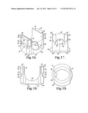 Polyaxial bone anchor with compound articulation and pop-on shank diagram and image