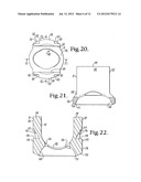 Polyaxial bone anchor with compound articulation and pop-on shank diagram and image