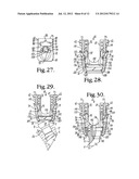 Polyaxial bone anchor with compound articulation and pop-on shank diagram and image