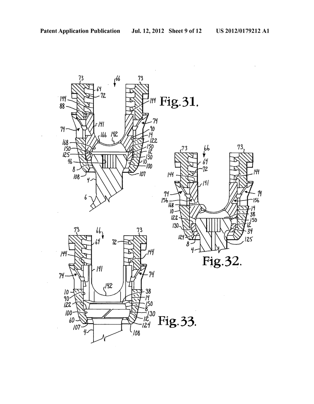 Polyaxial bone anchor with compound articulation and pop-on shank - diagram, schematic, and image 10