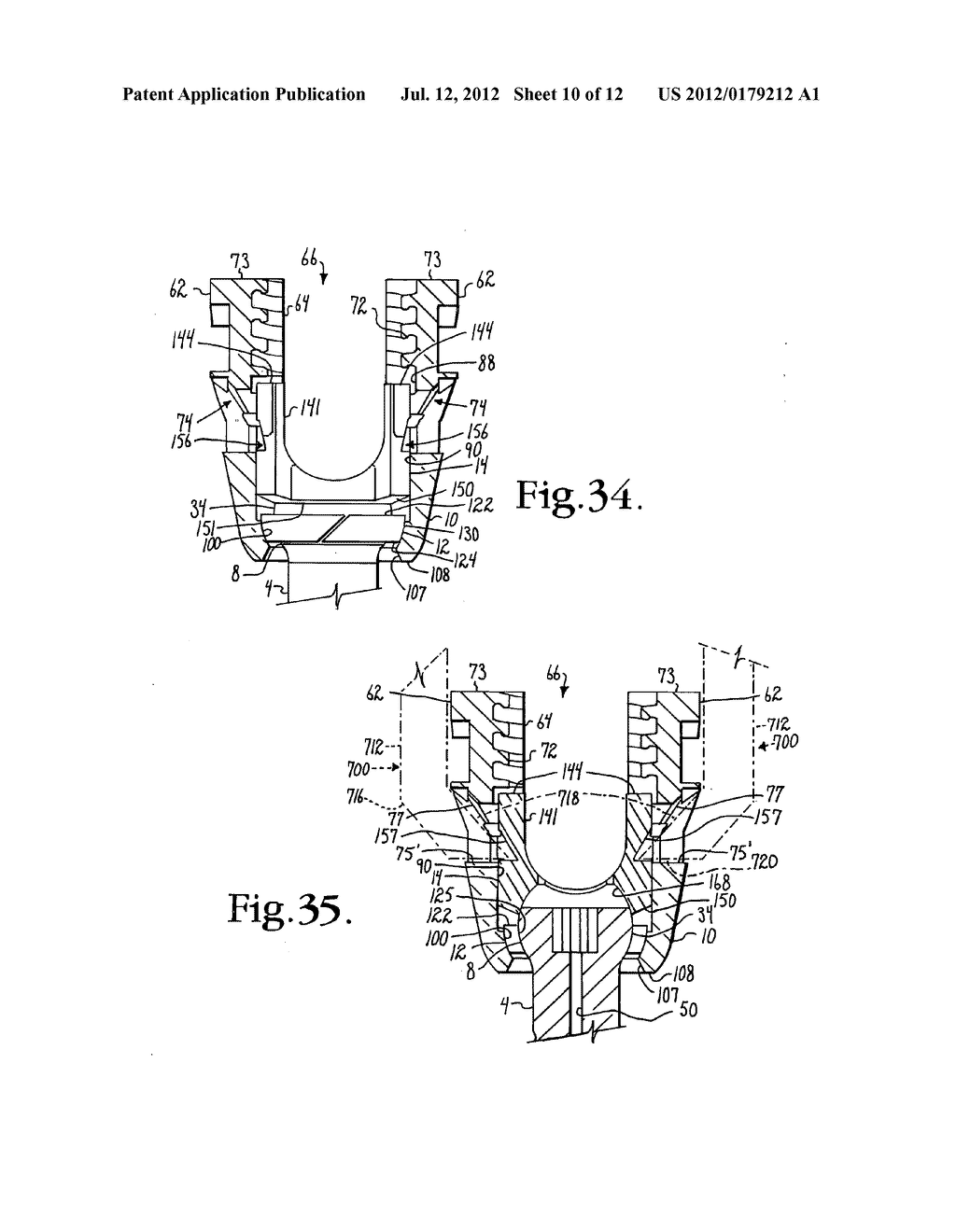 Polyaxial bone anchor with compound articulation and pop-on shank - diagram, schematic, and image 11