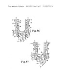 Polyaxial bone anchor with compound articulation and pop-on shank diagram and image