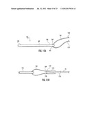 System for Pushing and Pulling Surgical Implants into Position in Vivo Via     a Tether diagram and image