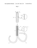 MITRAL VALVE CERCLARGE ANNULOPLASTY APPRATUS AND METHOD THEREOF diagram and image