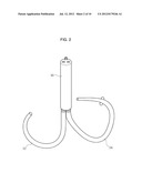 MITRAL VALVE CERCLARGE ANNULOPLASTY APPRATUS AND METHOD THEREOF diagram and image