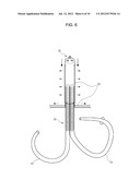 MITRAL VALVE CERCLARGE ANNULOPLASTY APPRATUS AND METHOD THEREOF diagram and image