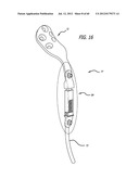 EXTRA-ARTICULAR IMPLANTABLE MECHANICAL ENERGY ABSORBING SYSTEMS AND     IMPLANTATION METHOD diagram and image