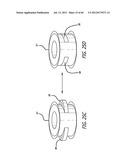 EXTRA-ARTICULAR IMPLANTABLE MECHANICAL ENERGY ABSORBING SYSTEMS AND     IMPLANTATION METHOD diagram and image