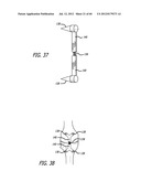 EXTRA-ARTICULAR IMPLANTABLE MECHANICAL ENERGY ABSORBING SYSTEMS AND     IMPLANTATION METHOD diagram and image