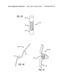 EXTRA-ARTICULAR IMPLANTABLE MECHANICAL ENERGY ABSORBING SYSTEMS AND     IMPLANTATION METHOD diagram and image