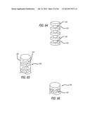 EXTRA-ARTICULAR IMPLANTABLE MECHANICAL ENERGY ABSORBING SYSTEMS AND     IMPLANTATION METHOD diagram and image