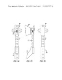 EXTRA-ARTICULAR IMPLANTABLE MECHANICAL ENERGY ABSORBING SYSTEMS AND     IMPLANTATION METHOD diagram and image