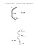 EXTRA-ARTICULAR IMPLANTABLE MECHANICAL ENERGY ABSORBING SYSTEMS AND     IMPLANTATION METHOD diagram and image