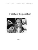 SYSTEMS FOR DENTURE PREPARATION diagram and image