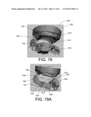 SYSTEMS FOR DENTURE PREPARATION diagram and image