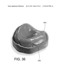 SYSTEMS FOR DENTURE PREPARATION diagram and image