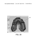 SYSTEMS FOR DENTURE PREPARATION diagram and image