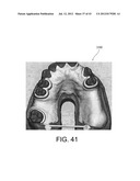 SYSTEMS FOR DENTURE PREPARATION diagram and image