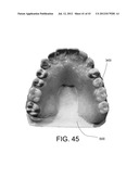 SYSTEMS FOR DENTURE PREPARATION diagram and image