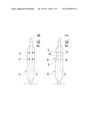 PERCUTANEOUS DILATIONAL DEVICE HAVING BALLOON RETENTION MECHANISM diagram and image