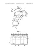 Tracheostomy Tubes diagram and image