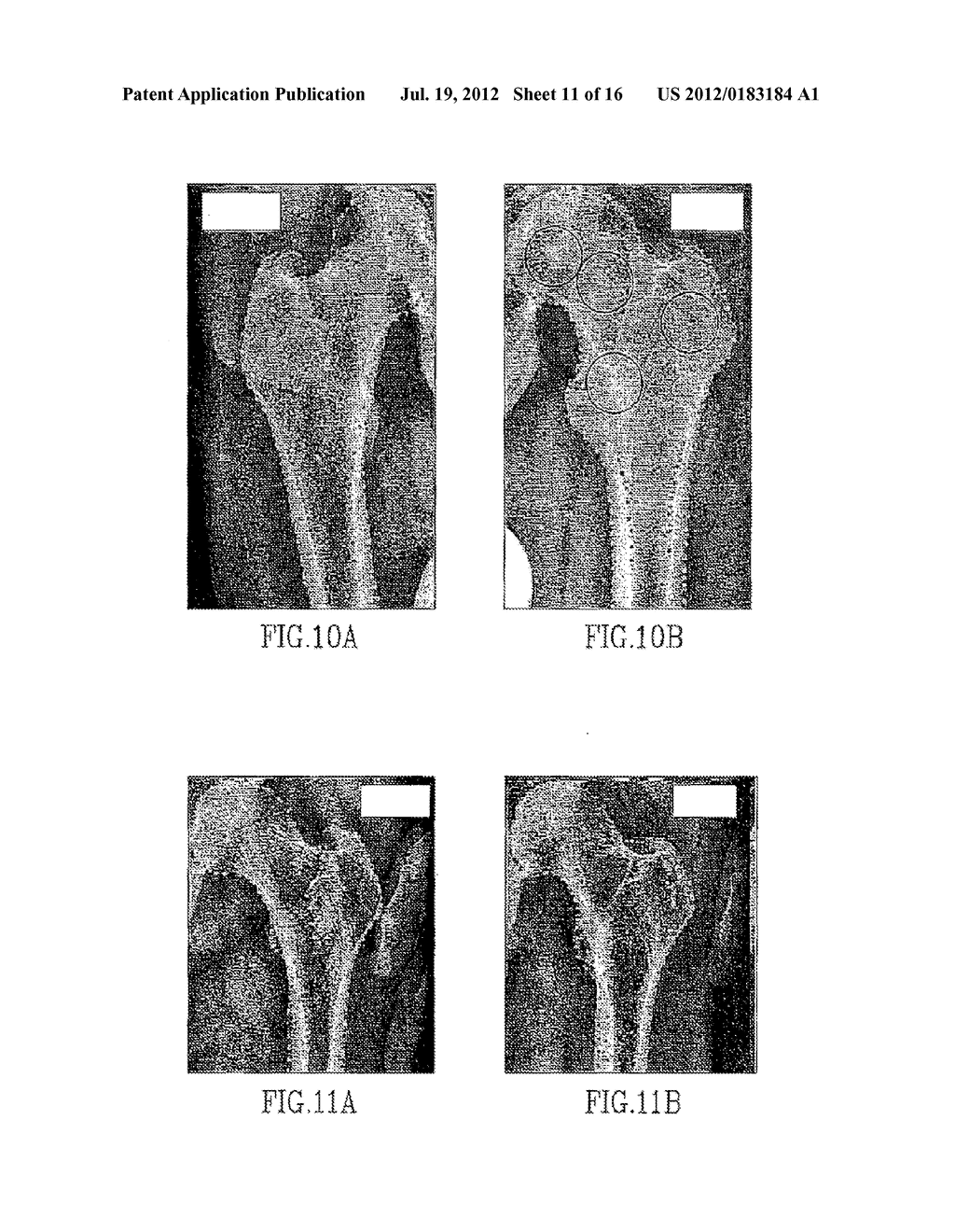 MEDICAL IMAGE ANALYSIS - diagram, schematic, and image 12