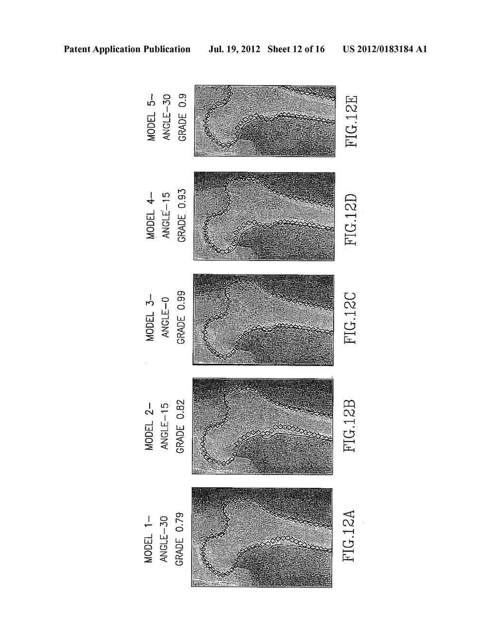 MEDICAL IMAGE ANALYSIS - diagram, schematic, and image 13