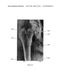 MEDICAL IMAGE ANALYSIS diagram and image