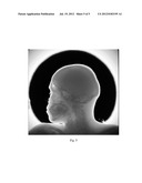 Noise Assessment Method for Digital X-ray Films diagram and image