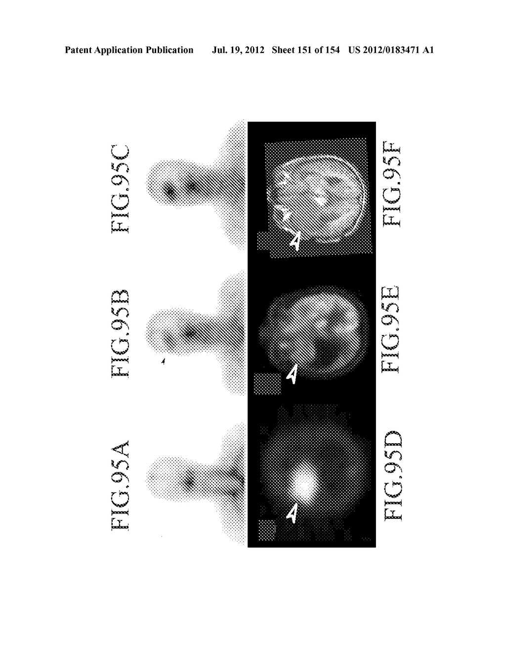 SPECIFIC BINDING PROTEINS AND USES THEREOF - diagram, schematic, and image 152