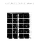 Methods and System for Detecting Soluble Amyloid-Beta diagram and image