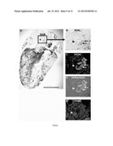 PNMT AS A NOVEL MARKER FOR PROGENITOR CELLS diagram and image