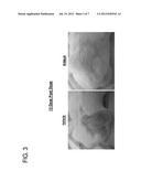 HAIR GROWTH METHODS USING  FGFR4 EXTRACELLULAR DOMAINS diagram and image